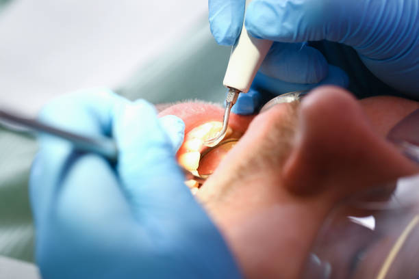 Best Emergency Denture Repair in New Middletown, OH