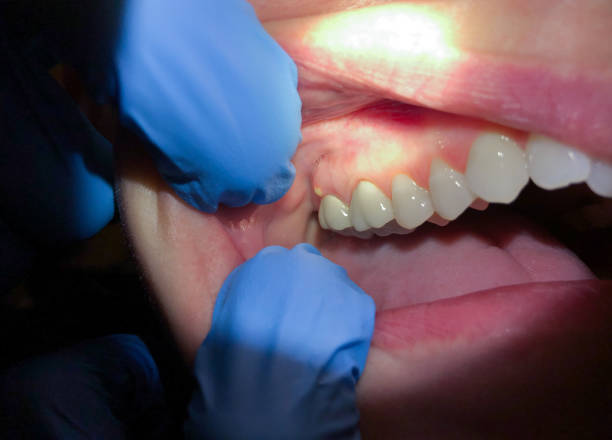 Best Emergency TMJ Treatment in New Middletown, OH