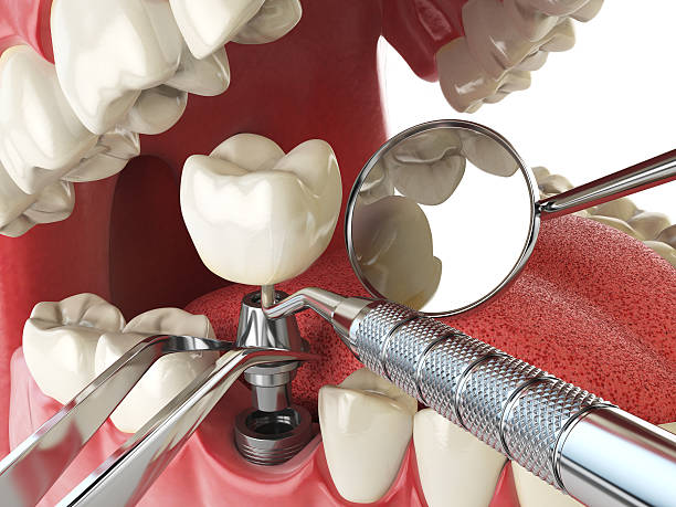 Best Same-Day Emergency Dental Services in New Middletown, OH